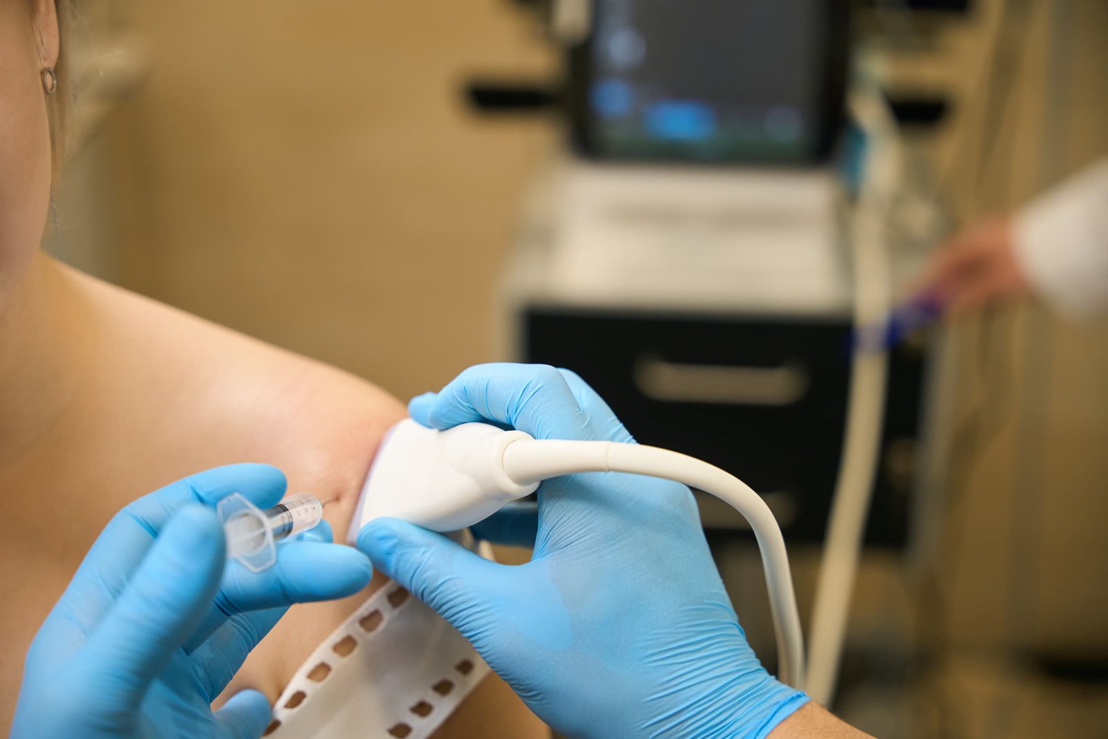 Arthrosamid Injections