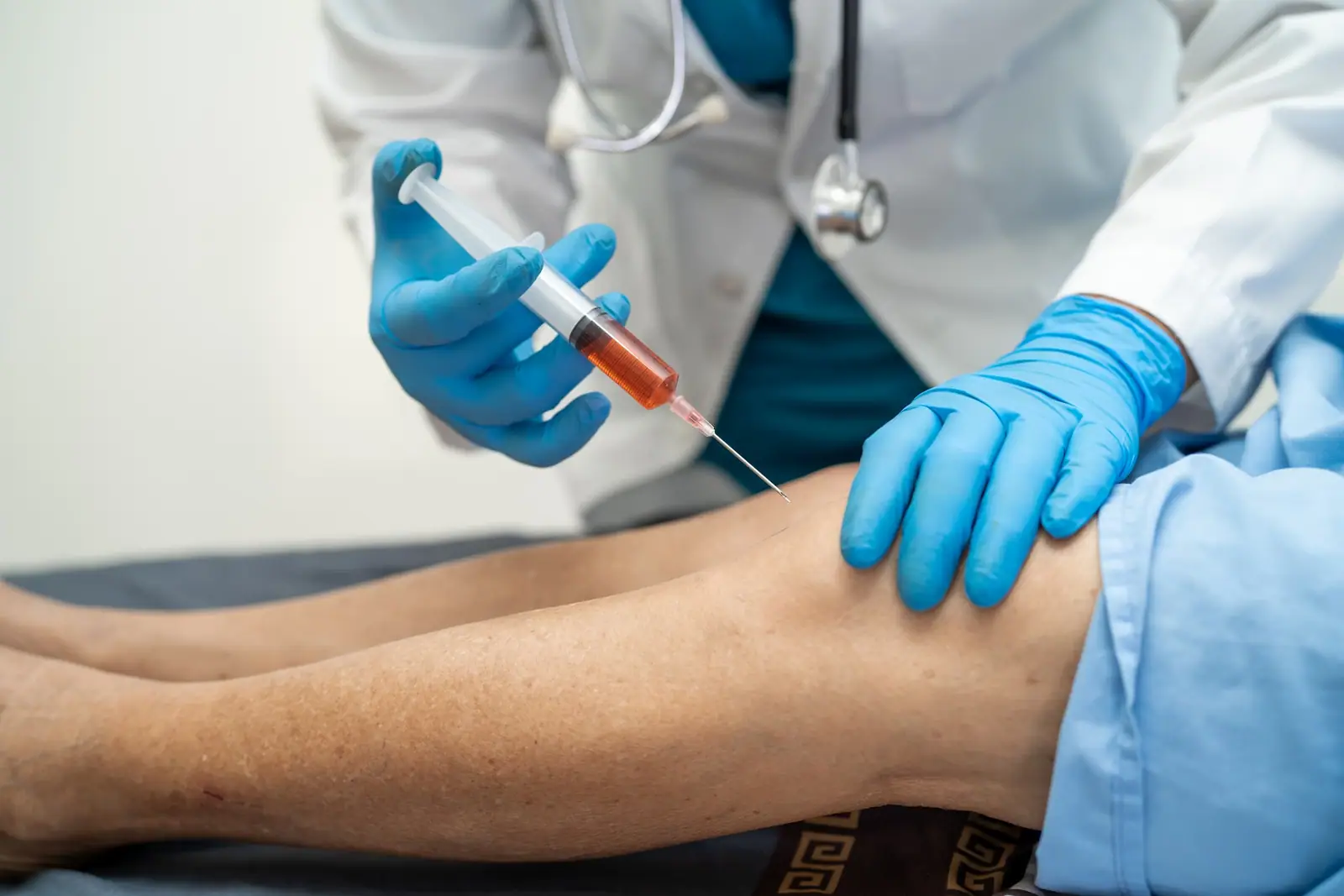Hydrodistension for Frozen Shoulder in London