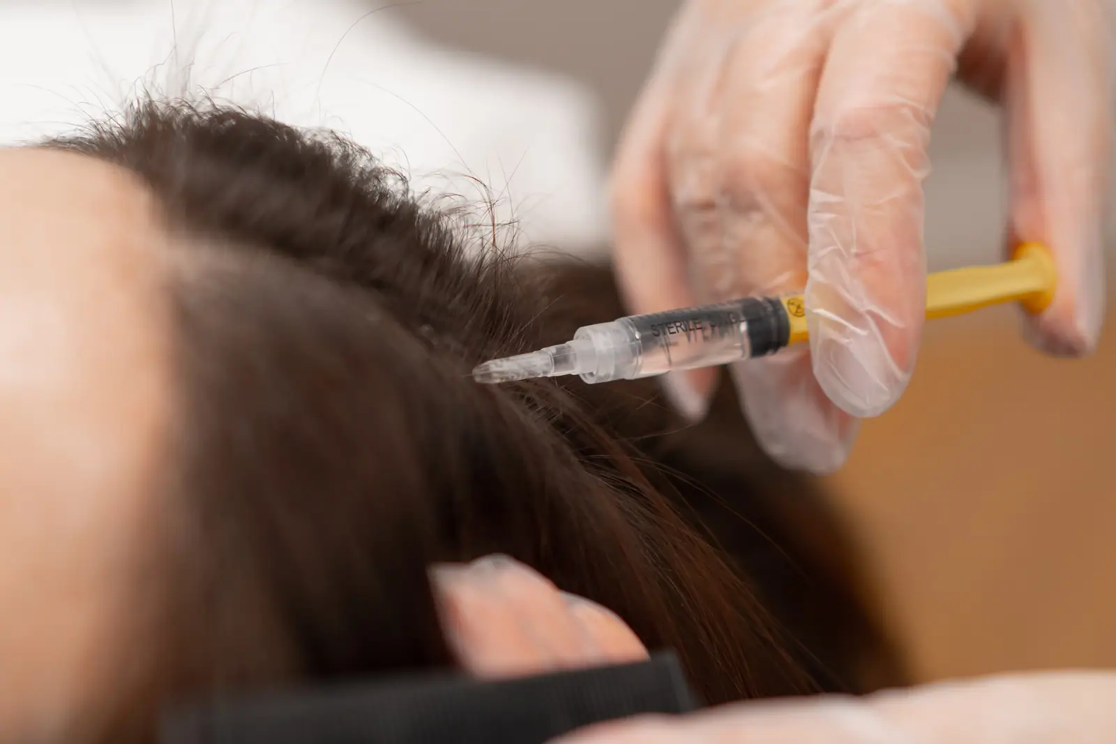 PRP Therapy
