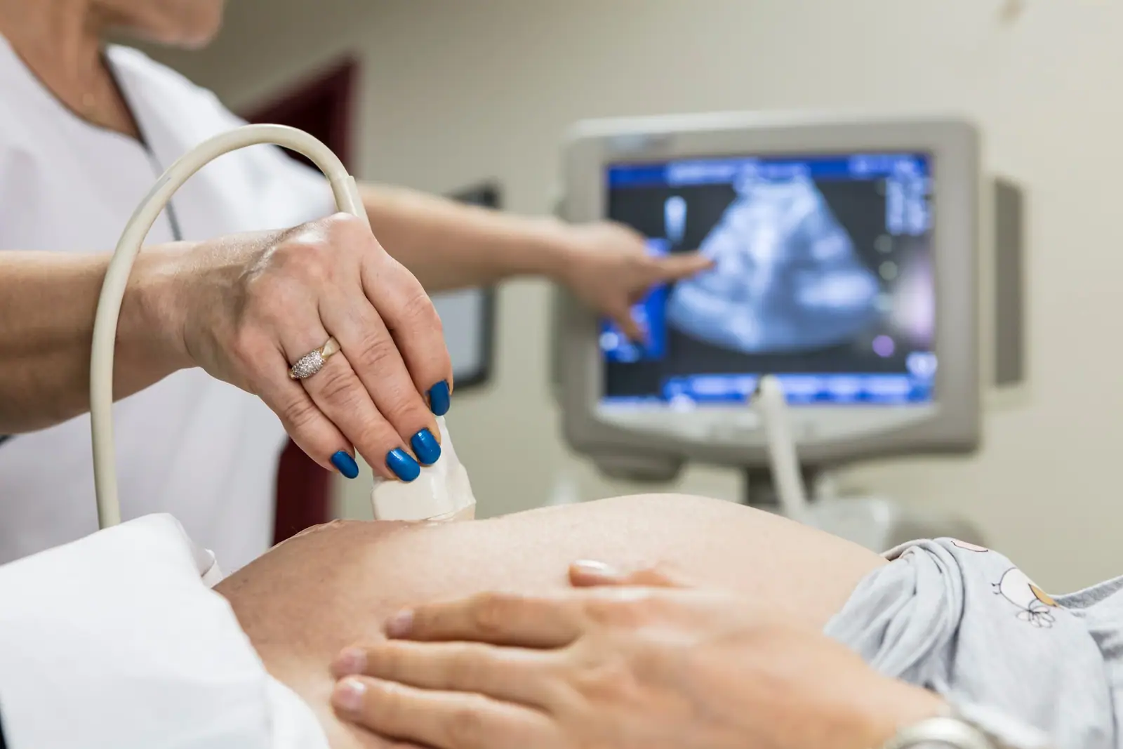 Ultrasound