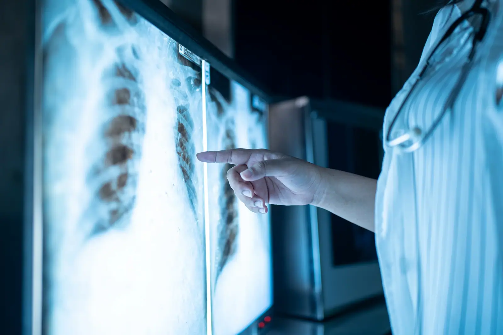 X-Ray