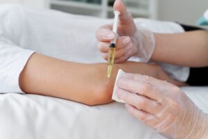 The Science Behind PRP Therapy for Musculoskeletal Injuries