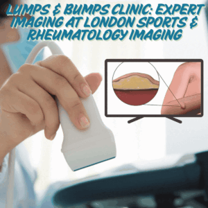 Lumps & Bumps Clinic: Expert Imaging at London Sports & Rheumatology Imaging