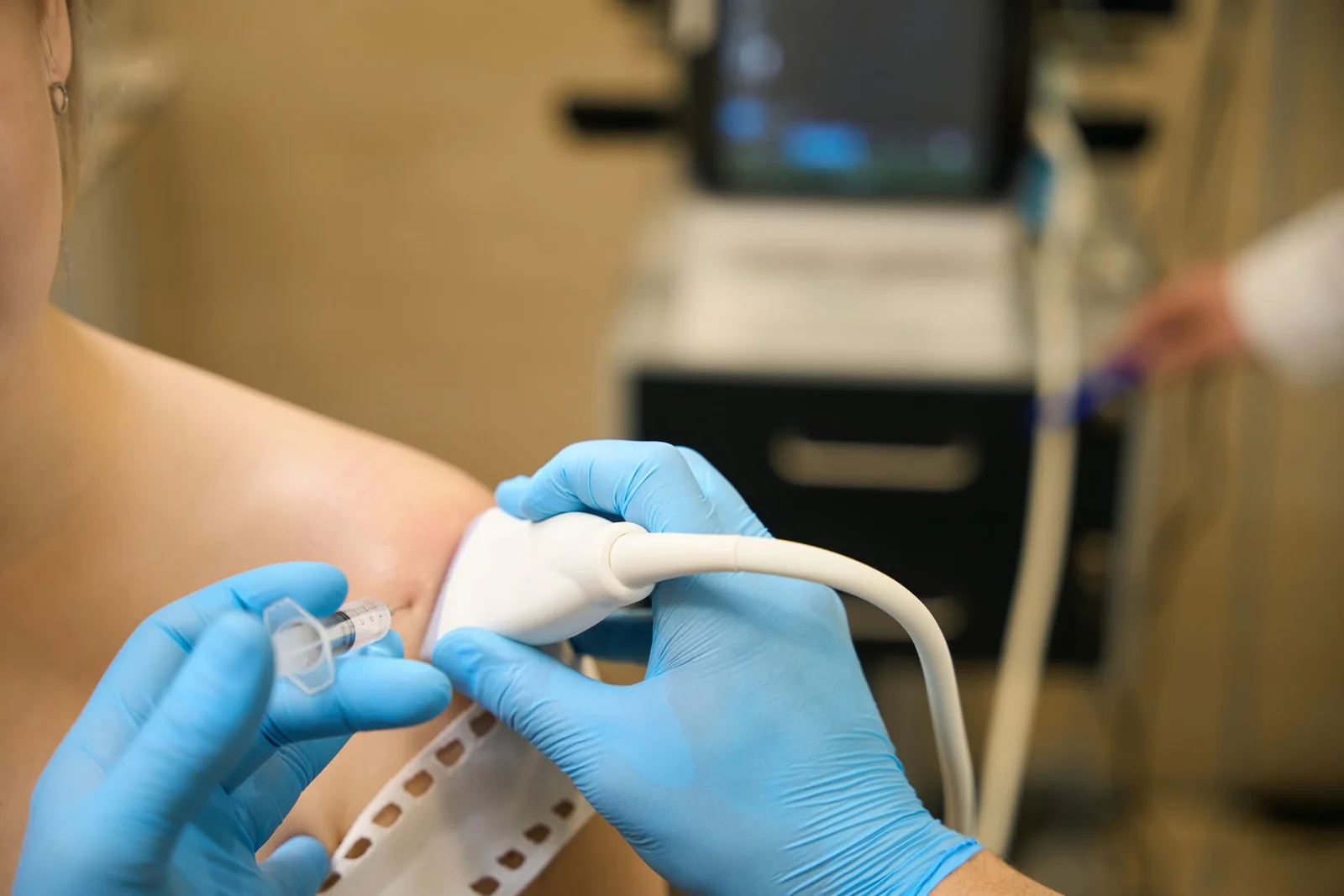 Arthrosamid Knee Injection London