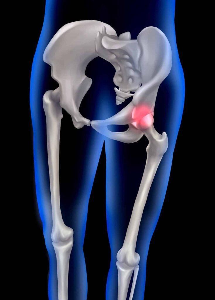 7 Best Tips for Safe Exercise With Arthritis: The Ultimate Guide