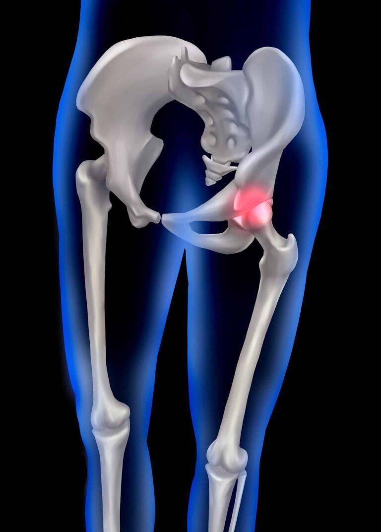 7 Best Tips for Safe Exercise With Arthritis: The Ultimate Guide