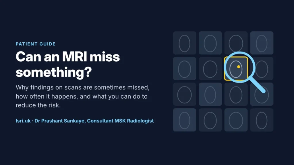 Can an MRI Miss Something? Why Scan Findings Get Missed, and How to Reduce the Risk