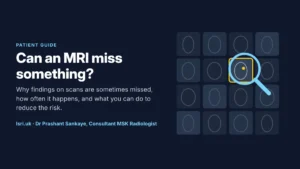 Can an MRI Miss Something? Why Scan Findings Get Missed, and How to Reduce the Risk