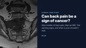 Can Back Pain Be a Sign of Cancer? A Case of Nine Months of Back Pain
