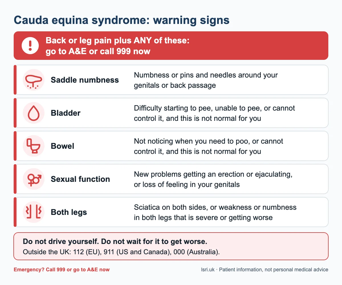 Cauda Equina Syndrome: Warning Signs and Why Hours Matter 2 Checklist of cauda equina syndrome symptoms: saddle numbness, bladder, bowel or sexual changes, or problems in both legs, with back or leg pain: go to A&E or call 999 now