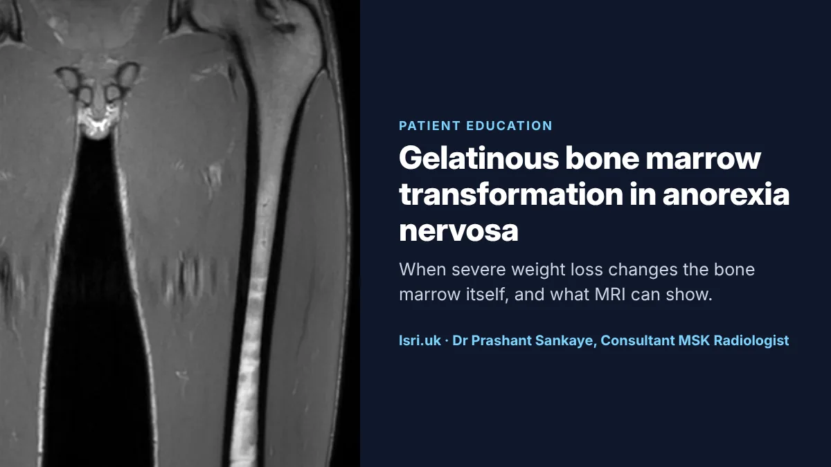 Gelatinous Bone Marrow Transformation in Anorexia Nervosa: What MRI Shows and Why It Matters