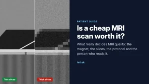 Is a Cheap MRI Scan Worth It? What Really Decides MRI Quality