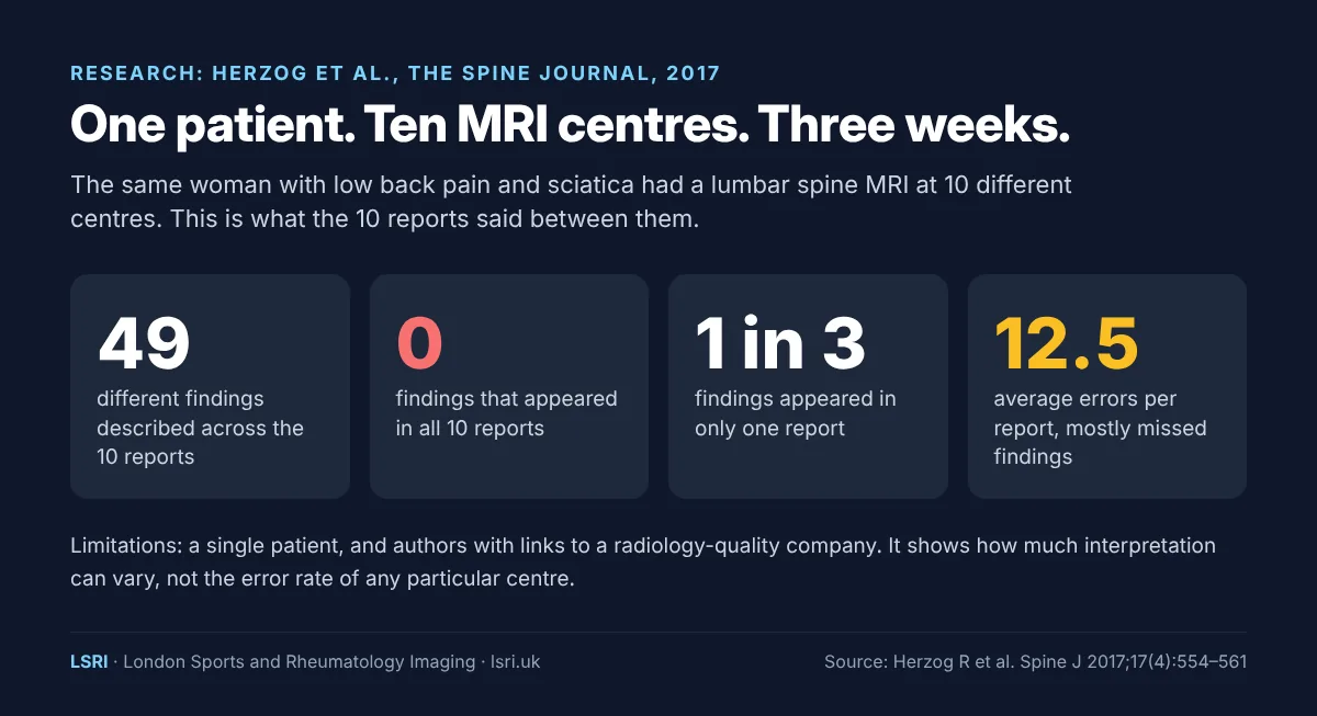 Is a Cheap MRI Scan Worth It? What Really Decides MRI Quality 3 Infographic of the Herzog 2017 Spine Journal study: one patient had lumbar spine MRI at 10 centres in three weeks, 49 different findings were reported and none appeared in all 10 reports. LSRI guide reviewed by Dr Prashant Sankaye, Consultant MSK Radiologist