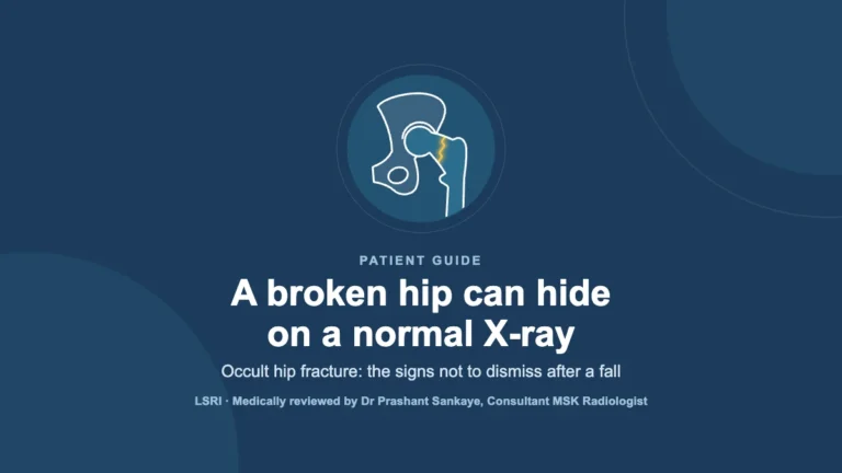 Can You Have a Broken Hip With a Normal X-Ray? Occult Hip Fractures Explained