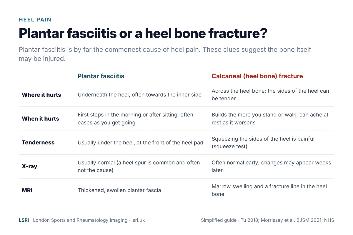 Eight Months of Heel Pain: A Calcaneal Fracture Found on MRI, and Why We Diagnose First 2 Comparison of plantar fasciitis and calcaneal fracture: where it hurts, when it hurts, the squeeze test, X-ray and MRI findings. From an LSRI guide reviewed by Dr Prashant Sankaye, Consultant MSK Radiologist