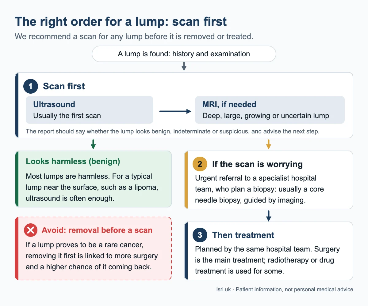 Pathway for a lump under the skin: scan first with ultrasound, then MRI if needed; if the scan is worrying, a specialist hospital team plans a biopsy, then treatment