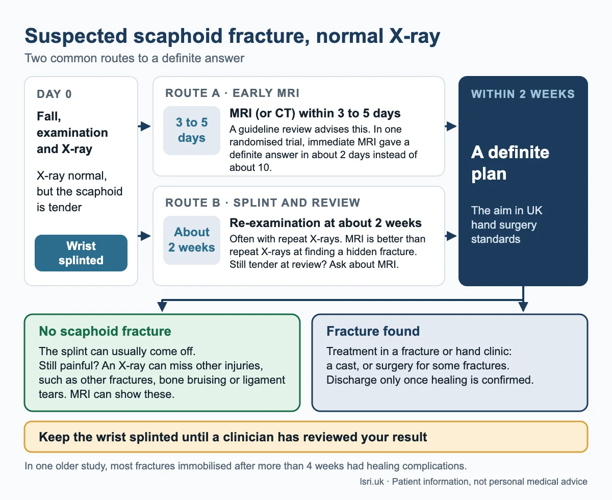 Pathway for a suspected scaphoid fracture with a normal X-ray: splint on day 0, early MRI or review at about 2 weeks, a definite plan, then the possible results