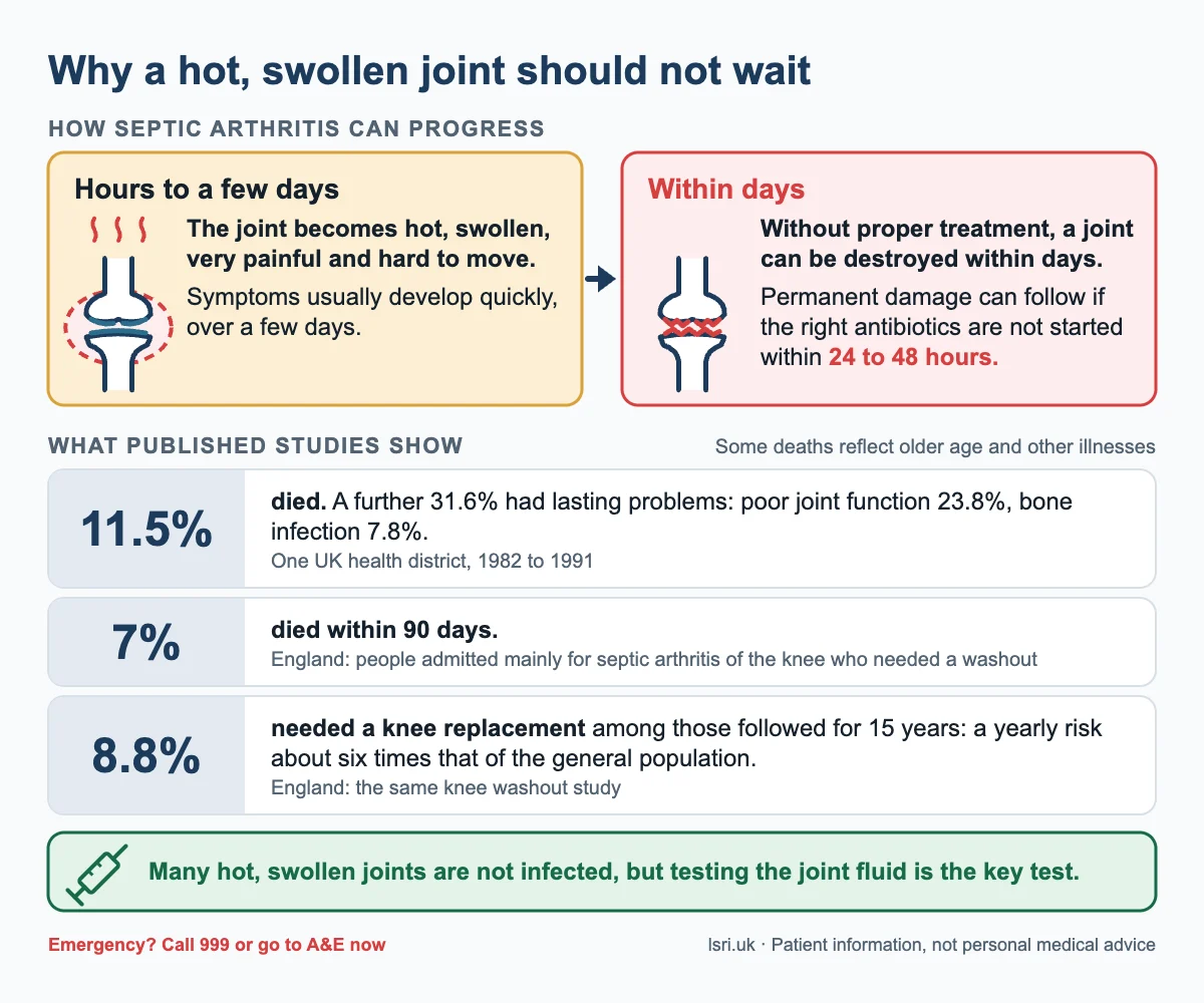 How septic arthritis can progress from a hot, swollen joint to joint damage within days, with death and knee replacement figures from published studies