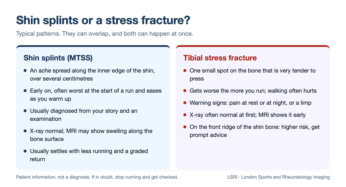 Comparison of shin splints and a tibial stress fracture: shin splints cause an ache spread along the inner shin that often eases as you warm up, with a normal X-ray; a stress fracture causes one very tender spot that gets worse with running and often hurts on walking, and may not show on an early X-ray; a stress fracture on the front ridge of the shin bone is higher risk