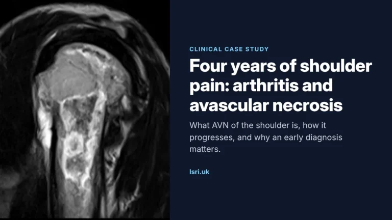 Four Years of Shoulder Pain: Osteoarthritis and Avascular Necrosis of the Shoulder