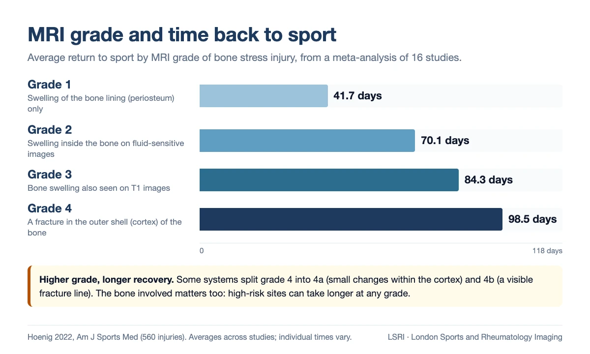Bar chart of MRI grade of bone stress injury against average time back to sport: grade 1, 41.7 days; grade 2, 70.1 days; grade 3, 84.3 days; grade 4, 98.5 days