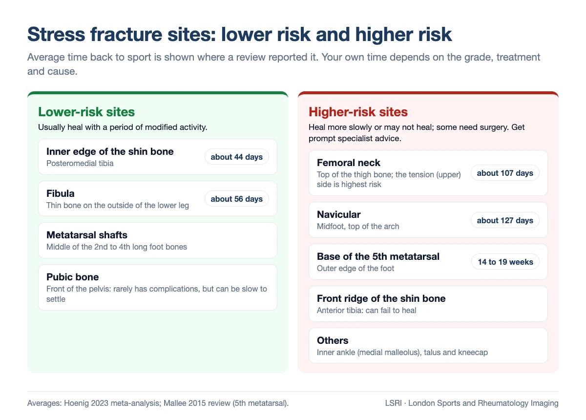 Table of lower-risk and higher-risk stress fracture sites with average time back to sport: inner shin bone about 44 days, fibula about 56 days, metatarsal shafts and pubic bone; femoral neck about 107 days, navicular about 127 days, base of the fifth metatarsal 14 to 19 weeks, front ridge of the shin bone, inner ankle, talus and kneecap