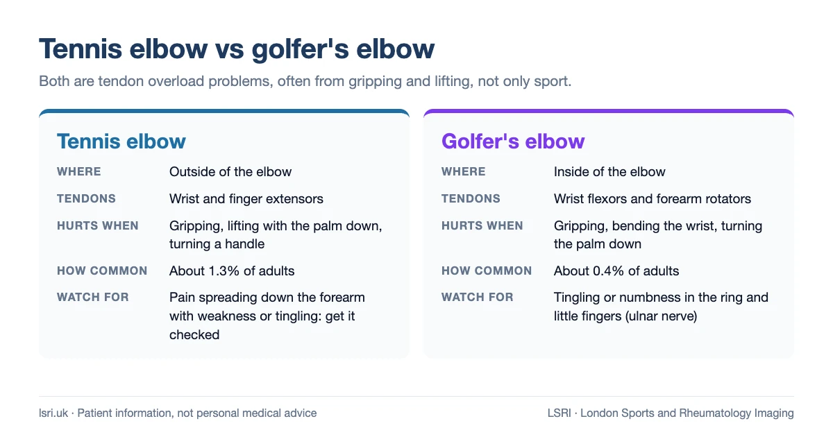 Comparison of tennis elbow and golfer's elbow: where the pain is, which tendons are affected, which movements hurt, how common each is and what to watch for