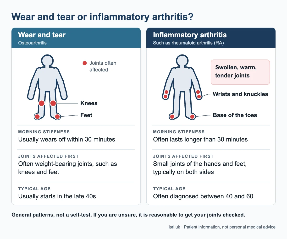 Osteoarthritis compared with early rheumatoid arthritis symptoms: which joints are affected, how long morning stiffness lasts and typical age at onset